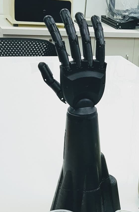 Prosthetic arm